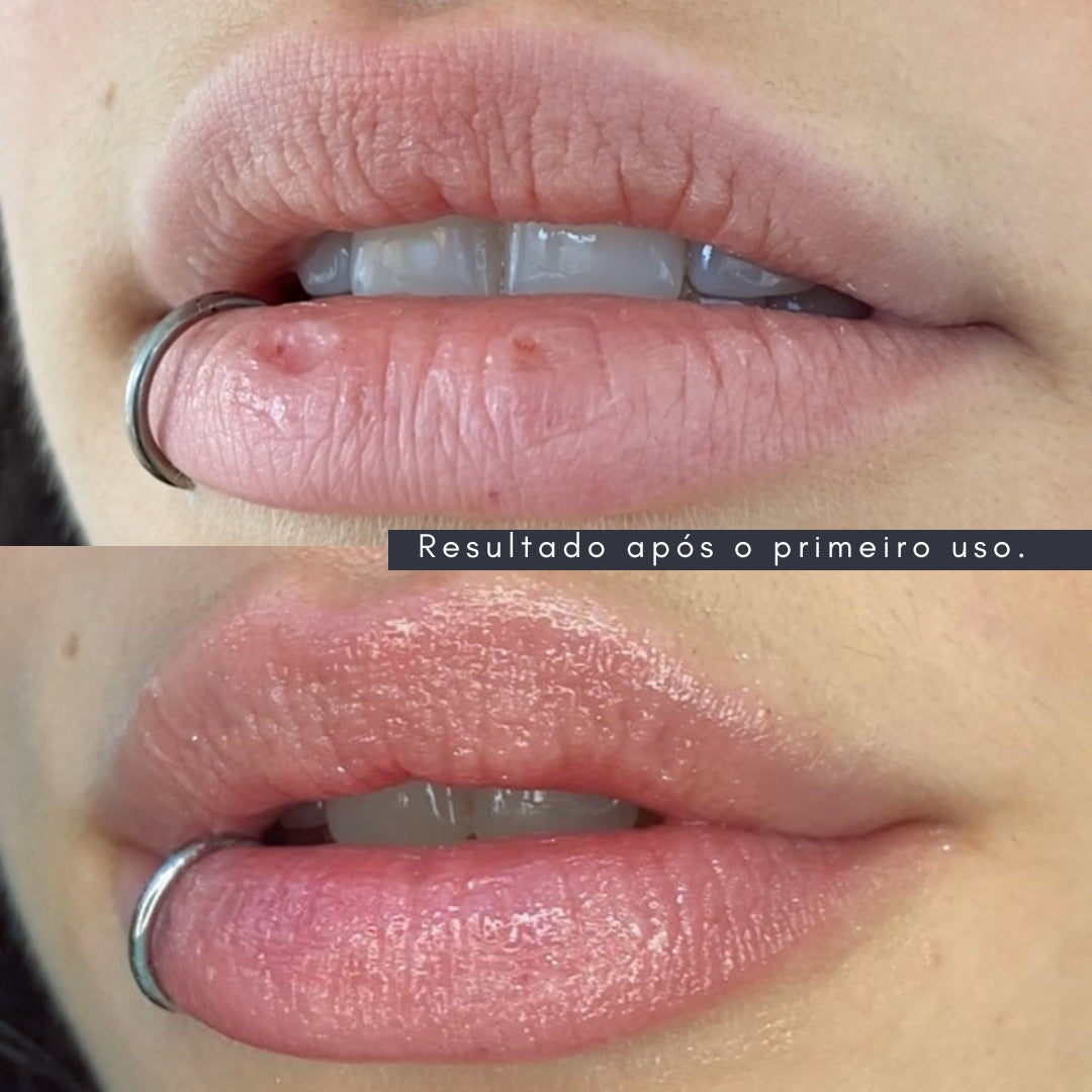 Máscara Labial Rejuvenescedora e Volumizadora Labial